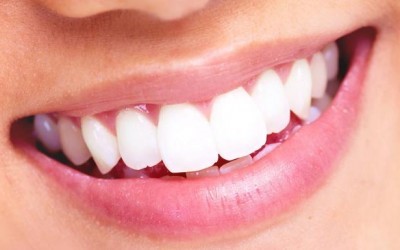 Falsos mites dentals que no has de creure